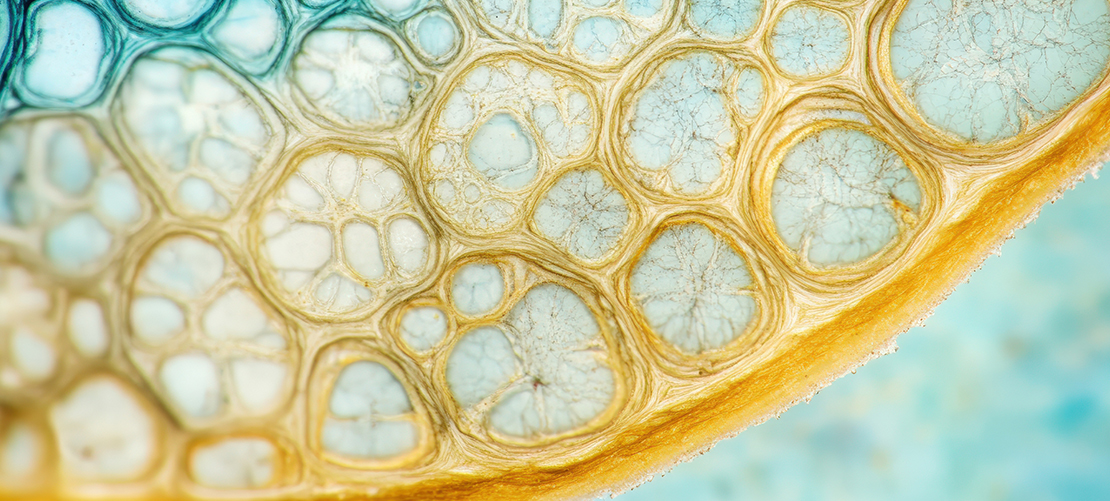 Life sciences A to Z - O is for (Employee Share) Options 